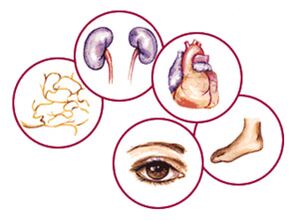 Organs to which complications of diabetes mellitus